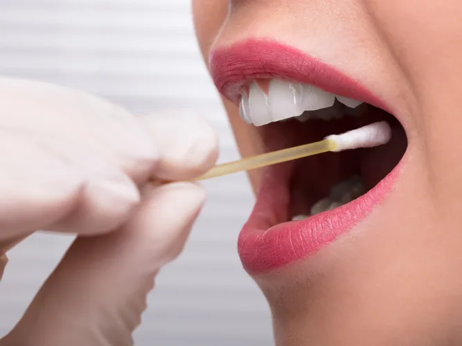 Oral thrush